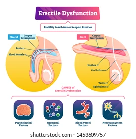 Erectile dysfunction (ED) affects millions of men globally, leading to stress, relationship strain, and lowered self-esteem. Thanks to advancements in medical science, medications like Begma 150mg (Sildenafil Citrate) have become a reliable and accessible solution.Erectile dysfunction (ED) affects millions of men globally, leading to stress, relationship strain, and lowered self-esteem. Thanks to advancements in medical science, medications like Begma 150mg (Sildenafil Citrate) have become a reliable and accessible solution.