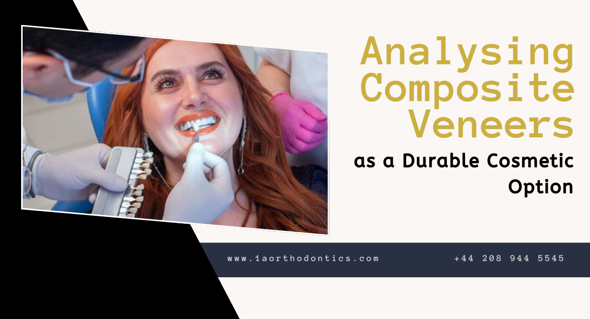 composite veneers in London
