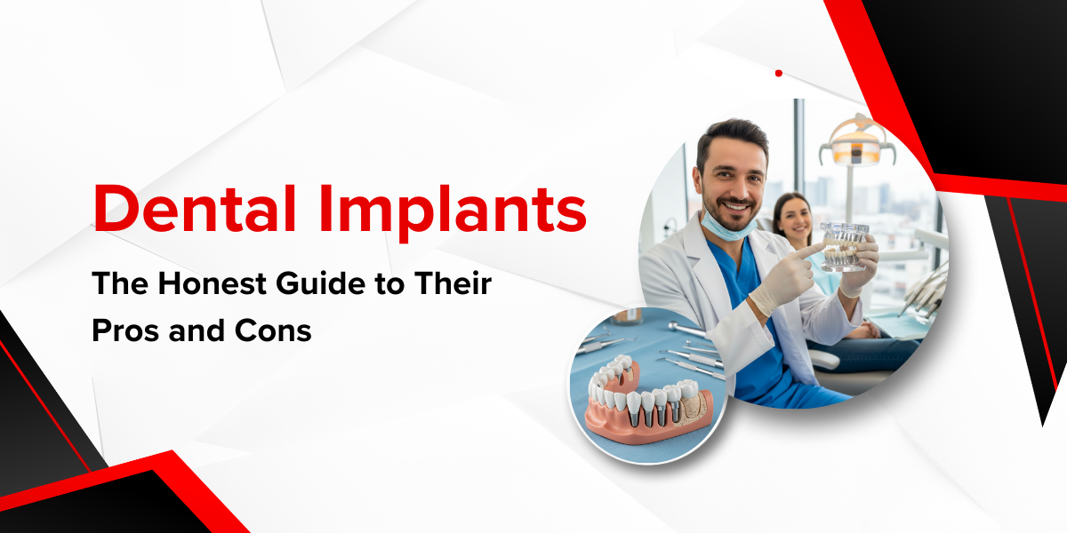 Dental Implants in London