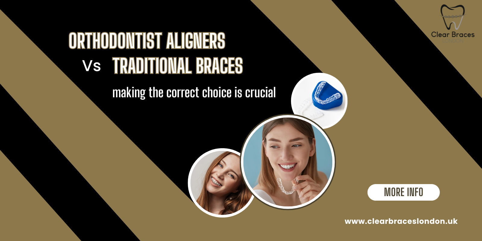 Orthodontist aligners versus traditional braces – making the correct choice is crucial
