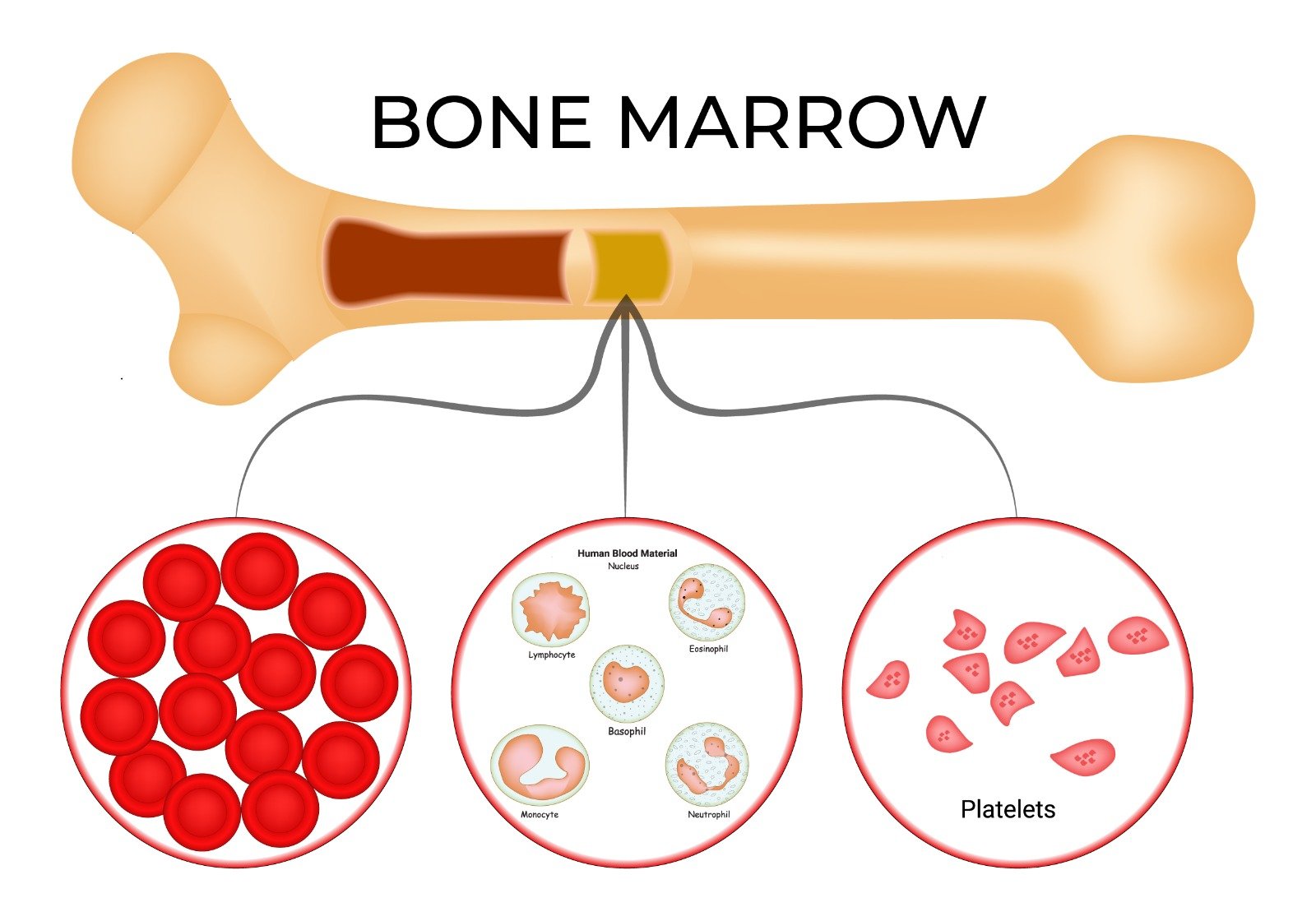Non-Surgical Bone marrow Treatment in Dallas