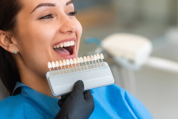 Veneers Treatment in Dumfries